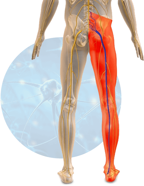 Sciatic Nerve