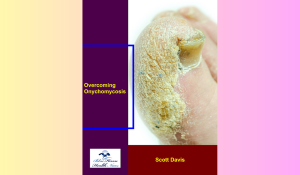 Overcoming Onychomycosis Reviews